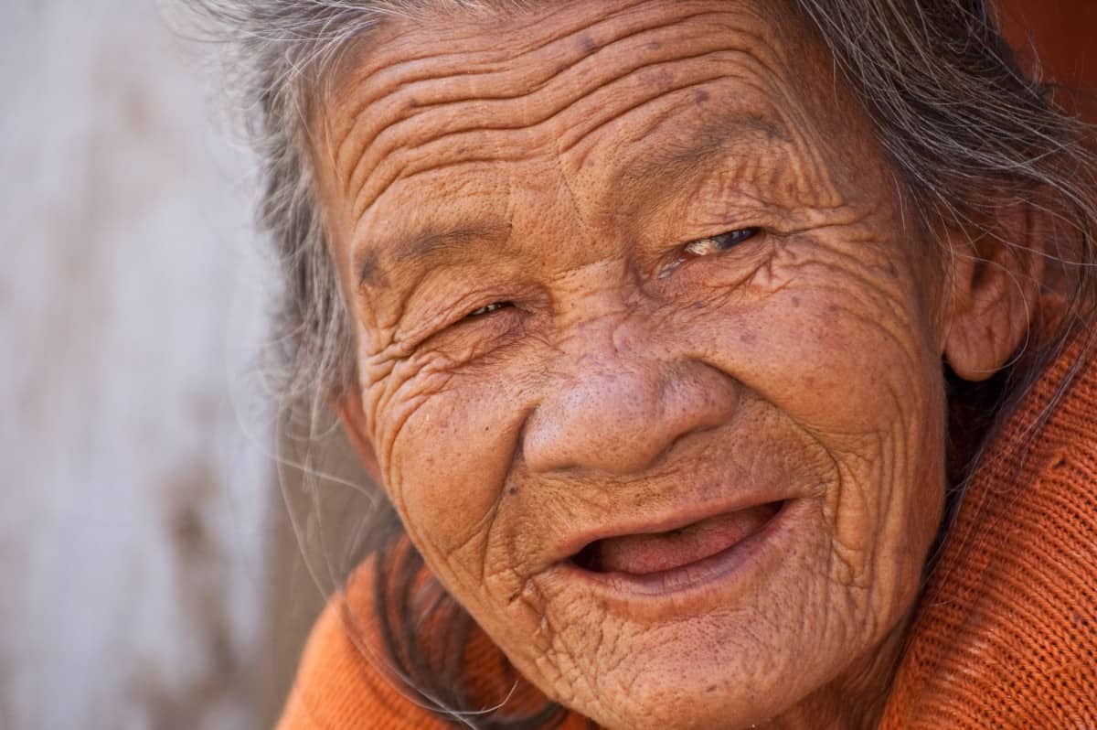 Image of wrinkles on the face of an aged lady.
